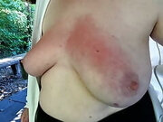 Red and swollen tits at bbq place