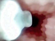 A detailed examination of Lopuza93 oral cavity and anal area using an endoscope camera.