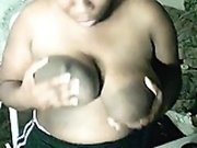 Unusual breasts black areolas